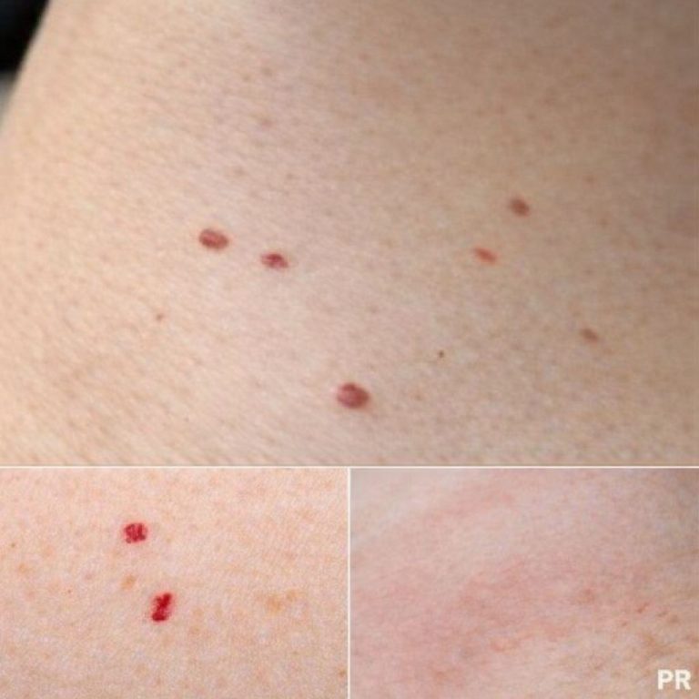 Red Dots on wrk Your Skin: Causes and What They Could Mean…